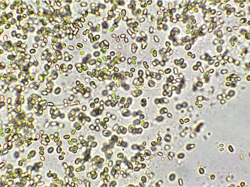 The Power of Chlorella vulgaris: A Sustainable Solution for Zero Hunger