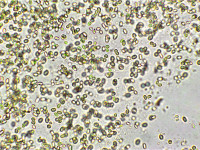 Chlorella vulgaris Μια Βιώσιμη Λύση για την εξάλειψη της Πείνας Chlorella vulgaris: Μια Βιώσιμη Λύση για την εξάλειψη της Πείνας